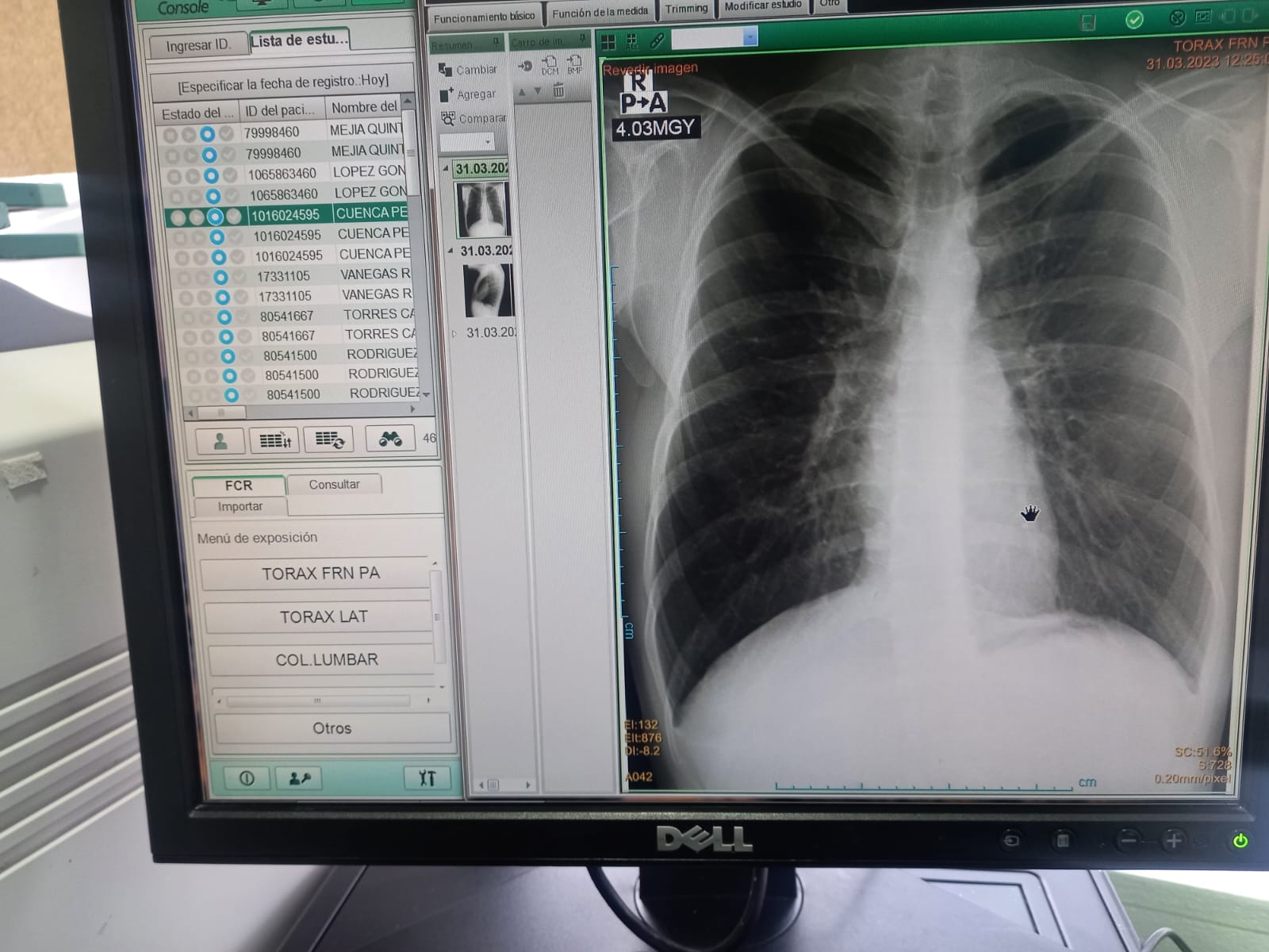 Equipo de Radiología